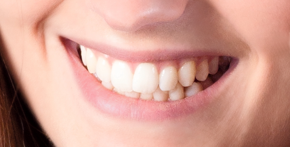 Lächelnder Mund mit weißen Zähnen